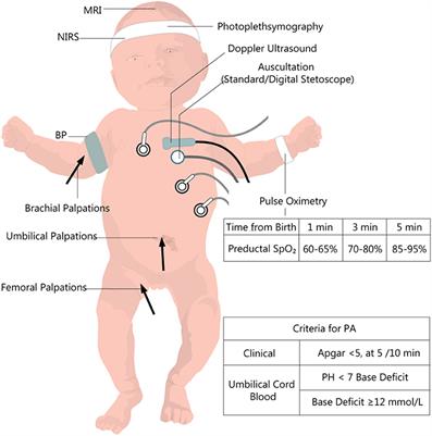 Getting an Early Start in Understanding Perinatal Asphyxia Impact on the Cardiovascular System